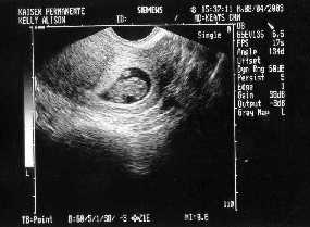 Click to popup fullsize image